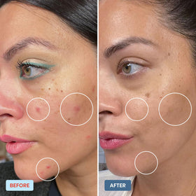 Daybreak Skincare mist spraying onto skin for instant soothing
