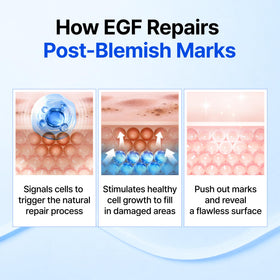 DearKlairs label ingredients close-up, highlights EGF FGF and azulene benefits