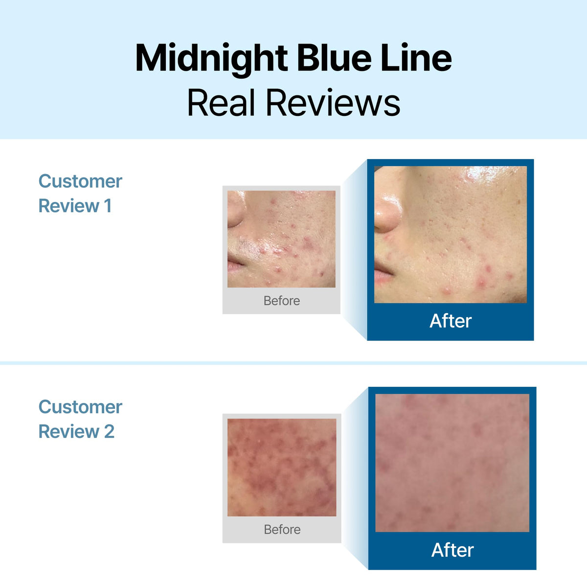 DearKlairs texture close-up highlighting silky blue cream and lightweight hydration benefit