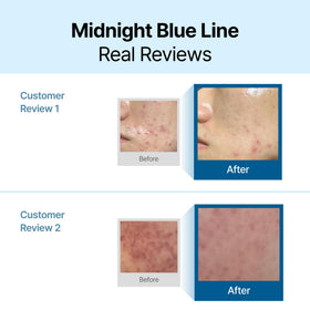 DearKlairs texture close-up highlighting silky blue cream and lightweight hydration benefit