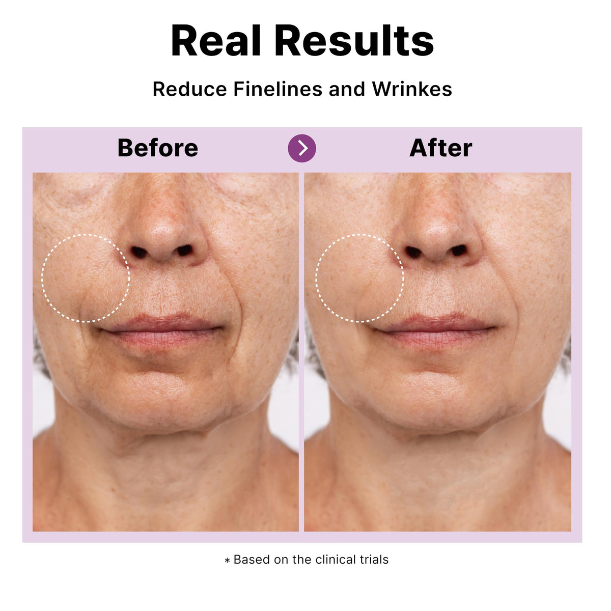 DearMYDEW application on hand illustrating quick absorption and non-greasy feel