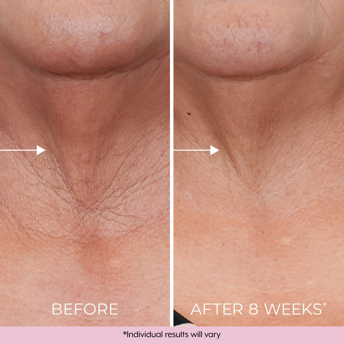 DEKLIDERM key ingredients retinol and bakuchiol for renewal
