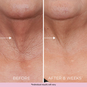 DEKLIDERM key ingredients retinol and bakuchiol for renewal