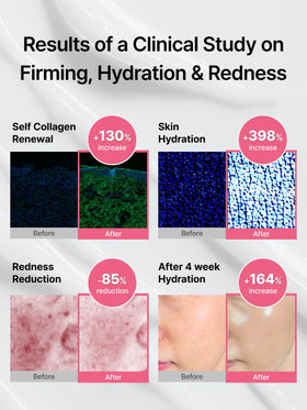 Delere visible glow comparison illustrating brighter, plumper skin