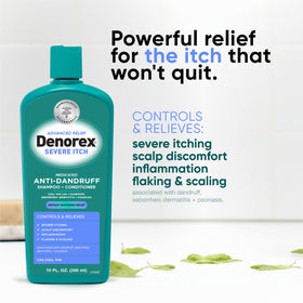 Denorex creamy foam texture on palm showing gentle lather for soothing scalp comfort