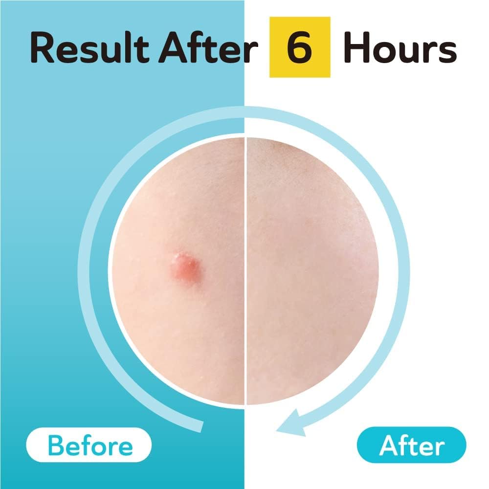 DERMA ANGEL product label highlighting TXA and CICA soothing benefits