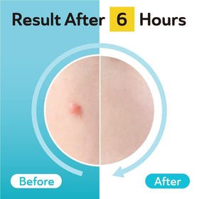 DERMA ANGEL product label highlighting TXA and CICA soothing benefits