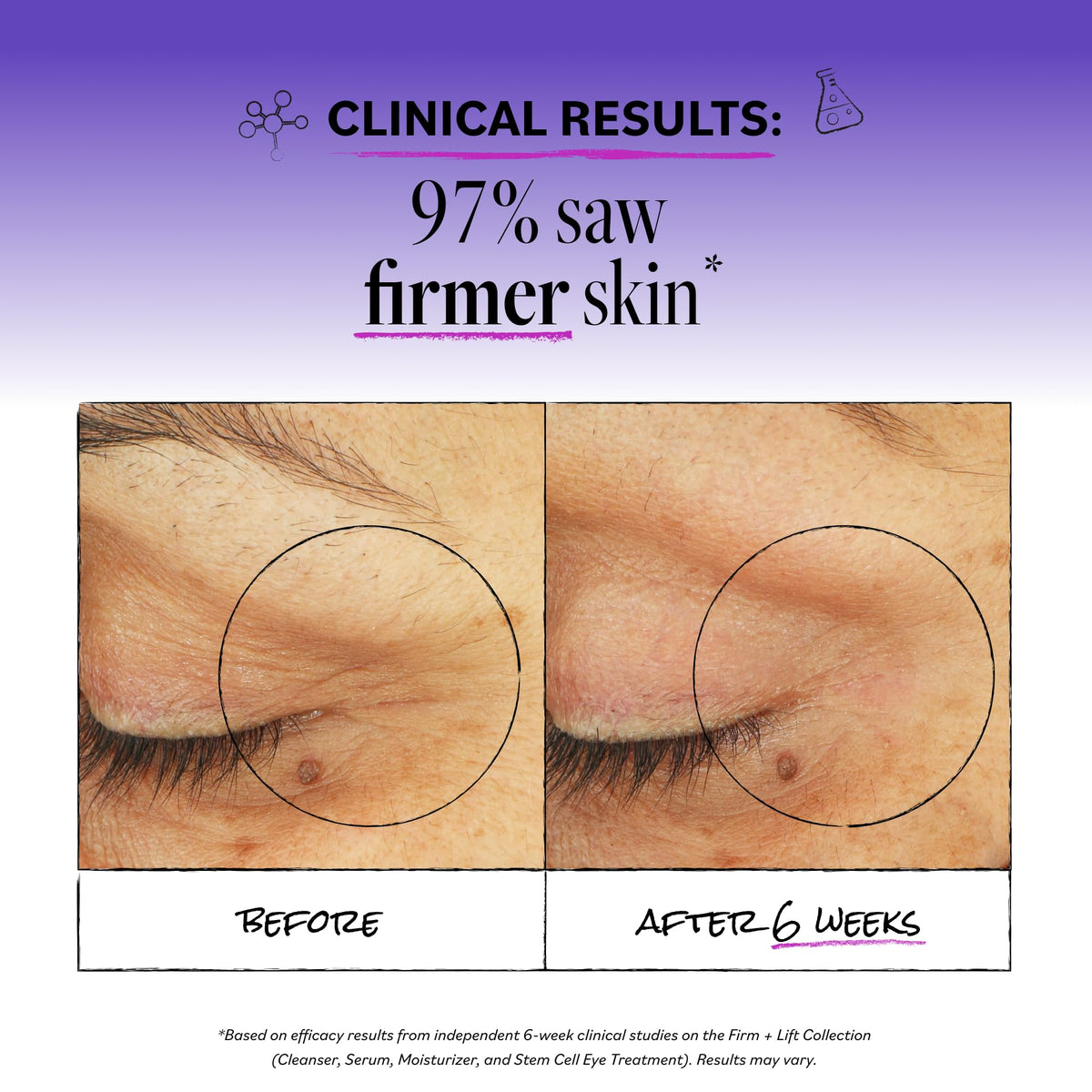 Derma E applied to upper eyelid demonstrating gentle lifting and hydration