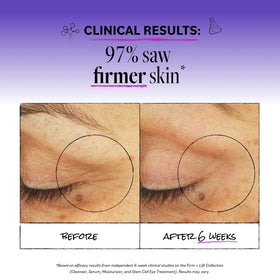 Derma E applied to upper eyelid demonstrating gentle lifting and hydration