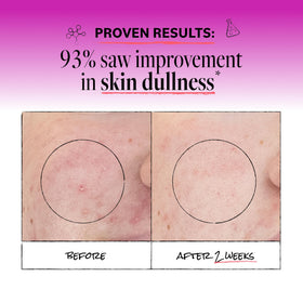 Derma E ingredient label zoom displaying kaolin clay and citrus oils for transparent formulation benefits