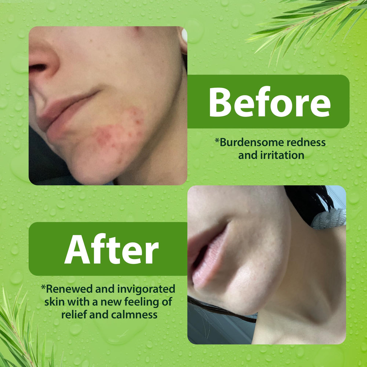 Derma-Nu back label close-up highlighting ingredient list and no-paraben benefit
