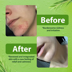Derma-Nu back label close-up highlighting ingredient list and no-paraben benefit