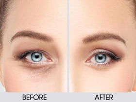 Dermactin simulated before and after illustration showing improved eyelid appearance