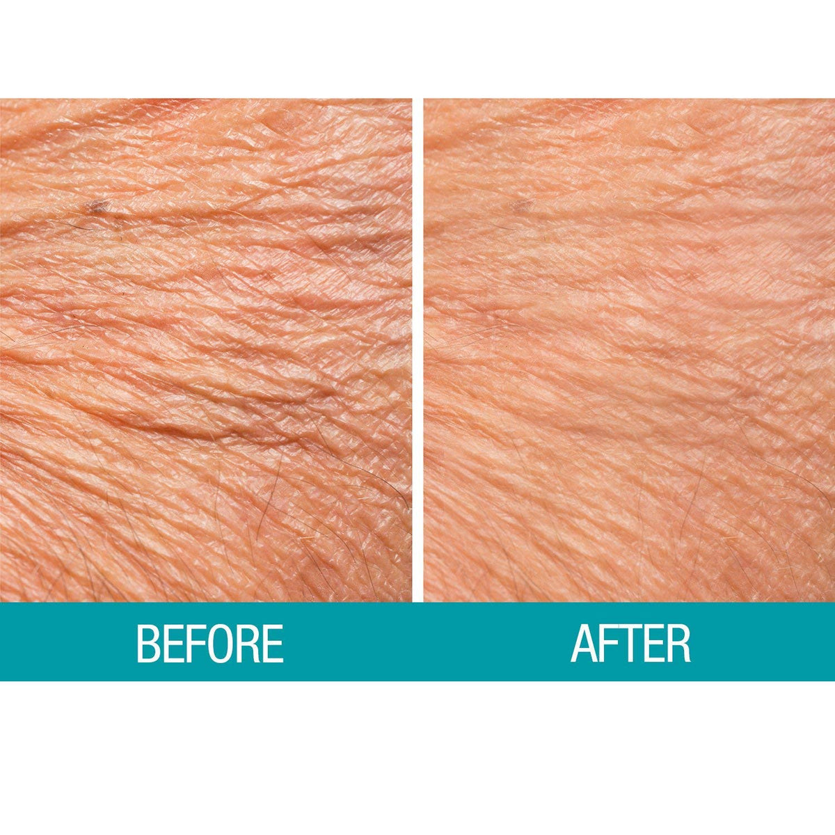 Dermactin label detail highlighting ingredients and product benefits