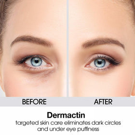 Dermactin before and after sample illustrating reduced visible fine lines