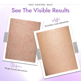 DERMAdoctor pouring scrub onto hand to show texture and easy application benefit