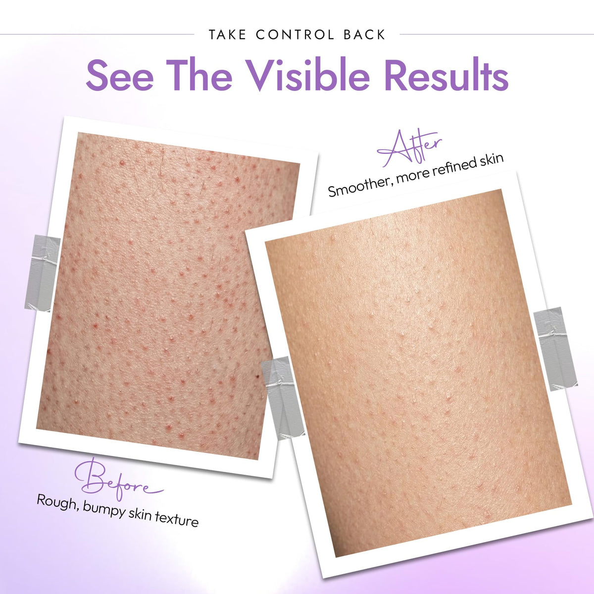 DERMAdoctor scrub in hand demonstrating spreadability and gentle physical exfoliation benefit