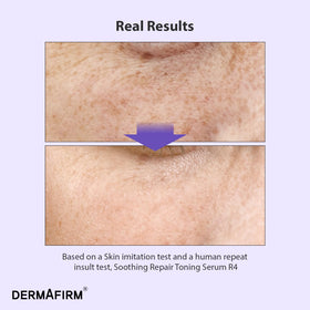 Dermafirm R4 ingredient focus with bakuchiol and niacinamide benefits