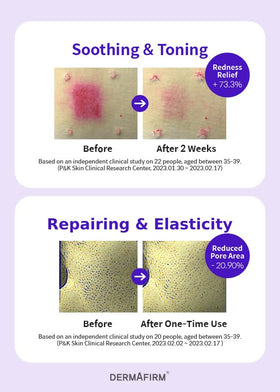 Dermafirm R4 being applied to skin demonstrating soothing absorption
