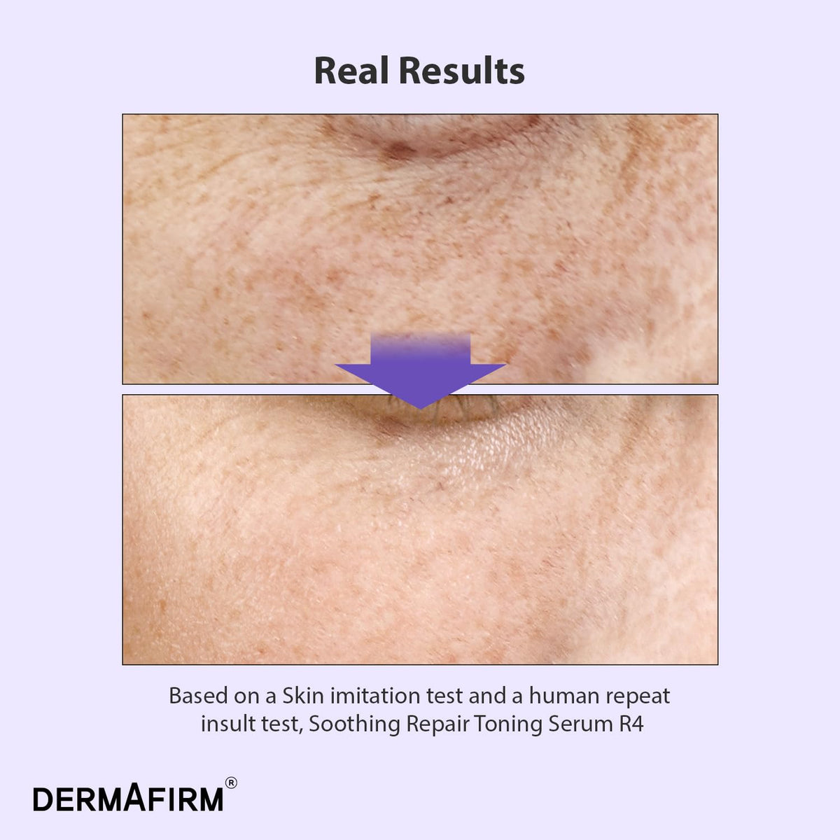 Dermafirm serum being applied to hand showing silky finish and hydration