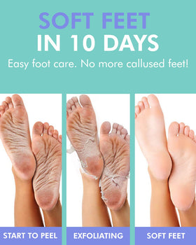 DERMAL foot inside sock mask during the 60–90 minute application for convenience