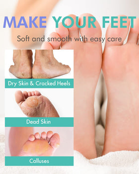 DERMAL before and after feet showing peeling and smoother heel transformation