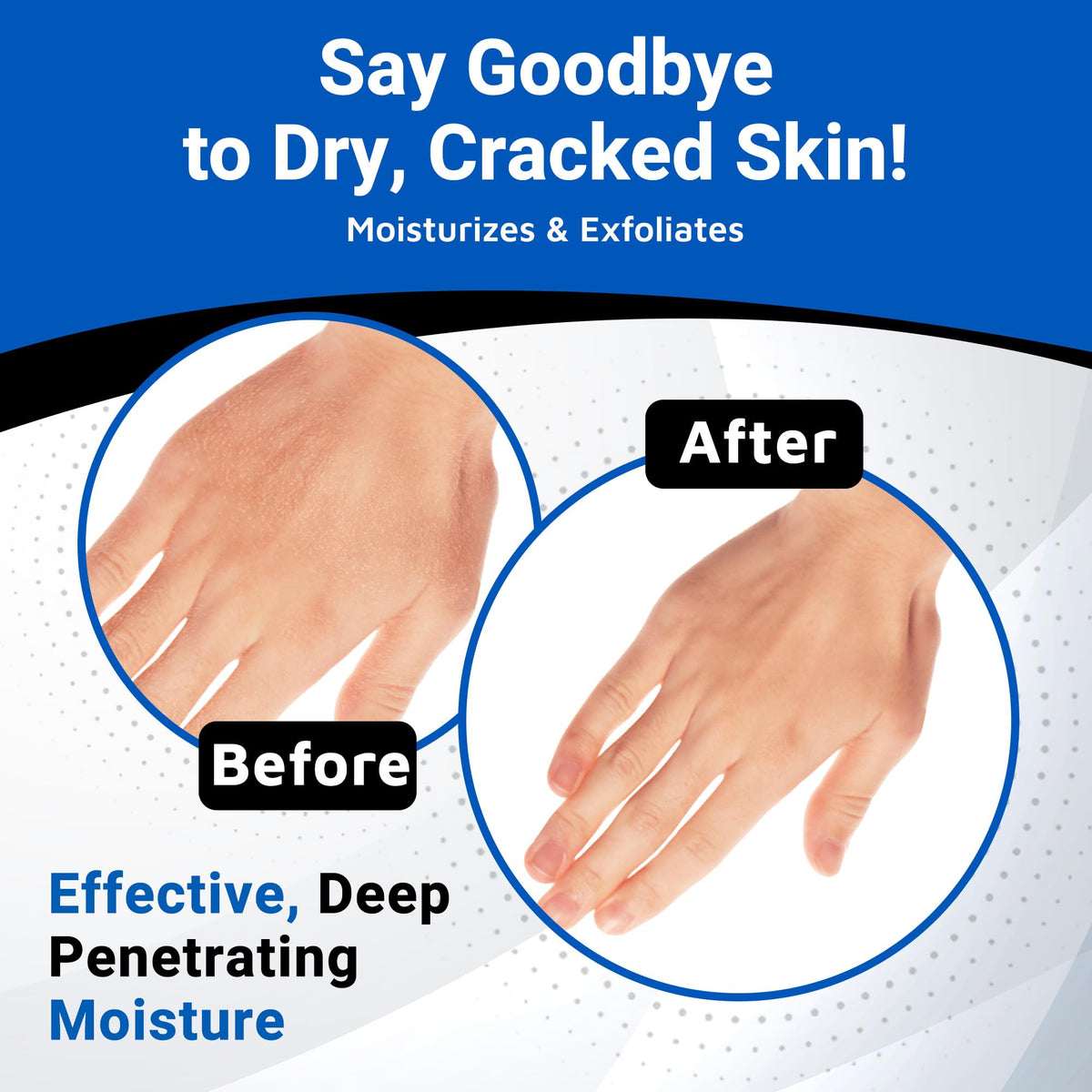 Dermal Therapy applied on arm demonstrating gentle exfoliation and improved skin softness