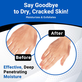 Dermal Therapy applied on arm demonstrating gentle exfoliation and improved skin softness