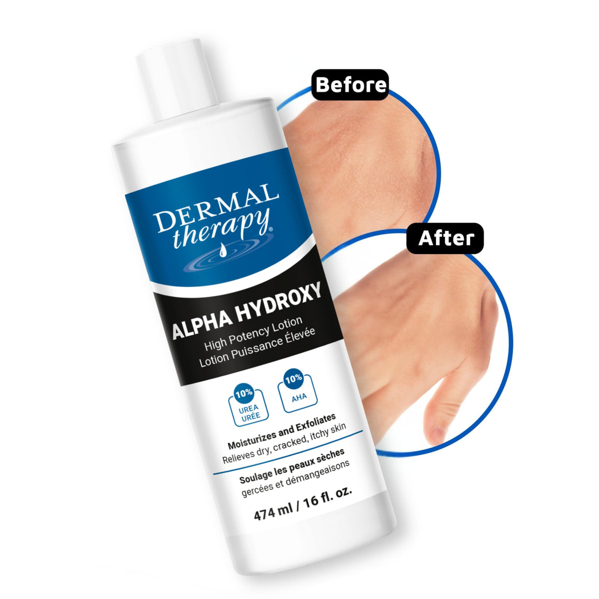 Dermal Therapy ingredients label closeup emphasizing 10% urea and 10% lactic acid for effectiveness