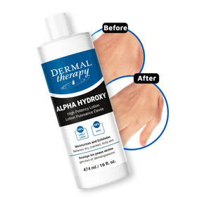 Dermal Therapy ingredients label closeup emphasizing 10% urea and 10% lactic acid for effectiveness