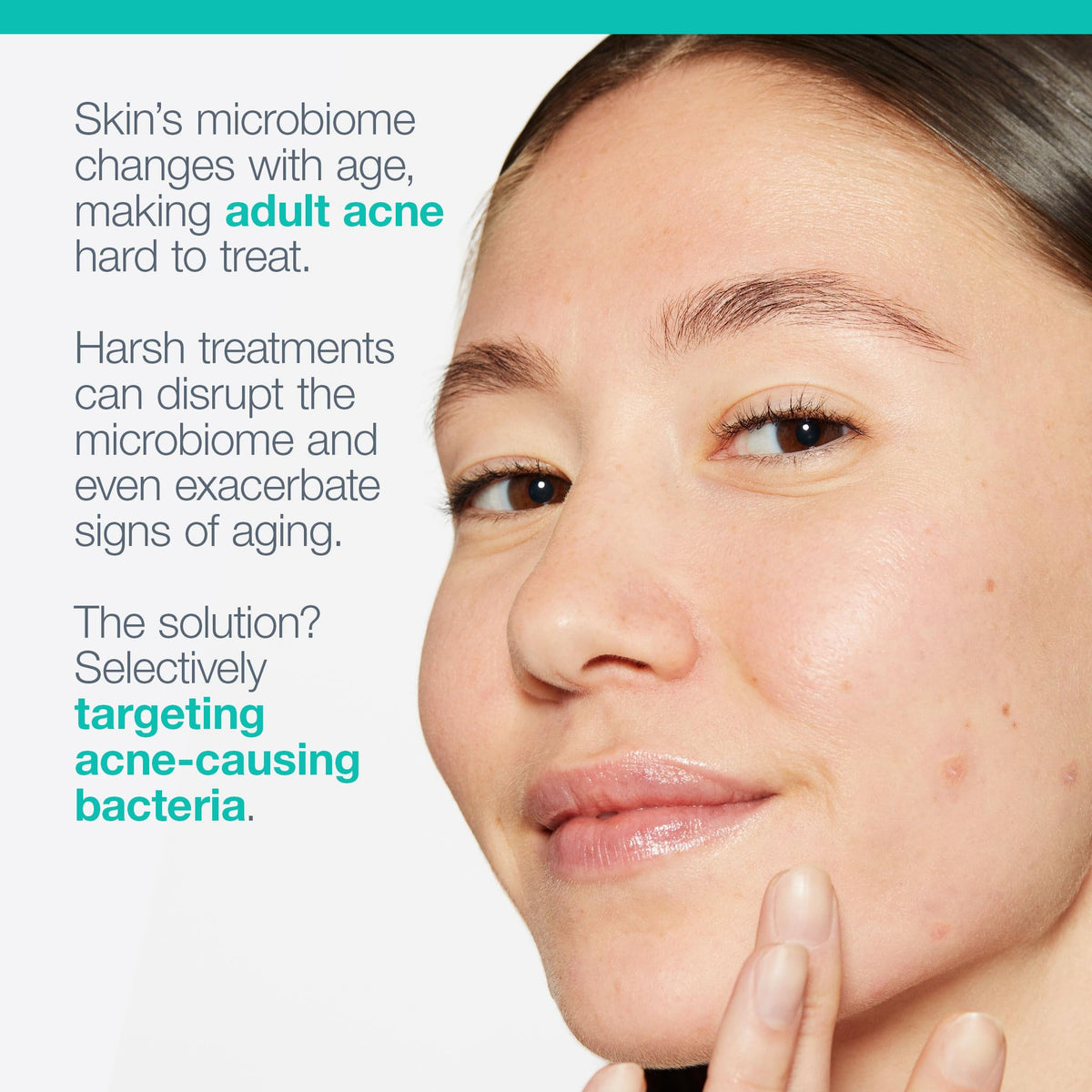 Dermalogica and raw botanicals representing prebiotic ingredient benefits