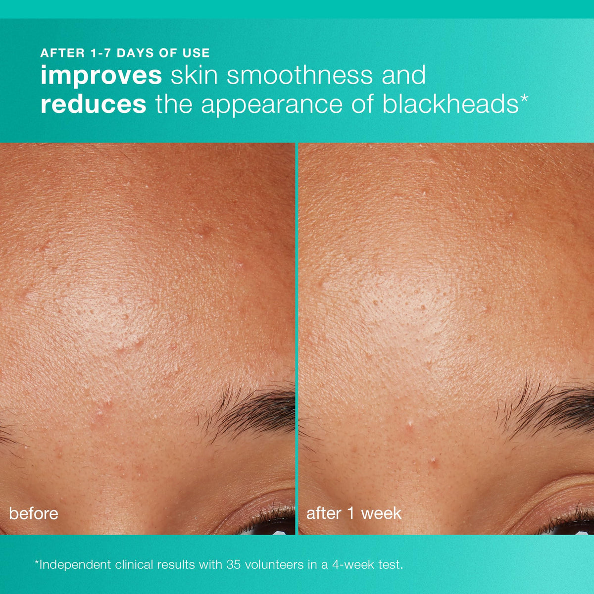 Dermalogica AGE Bright Clearing Serum droplet delivering targeted brightening benefits