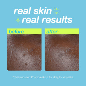 Dermalogica applying a small dab to a spot demonstrating targeted use
