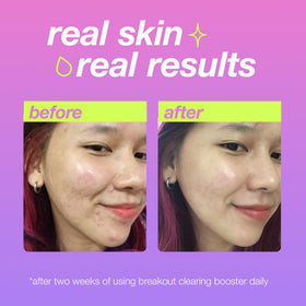 Dermalogica Clear Start booster texture close-up demonstrating quick absorption