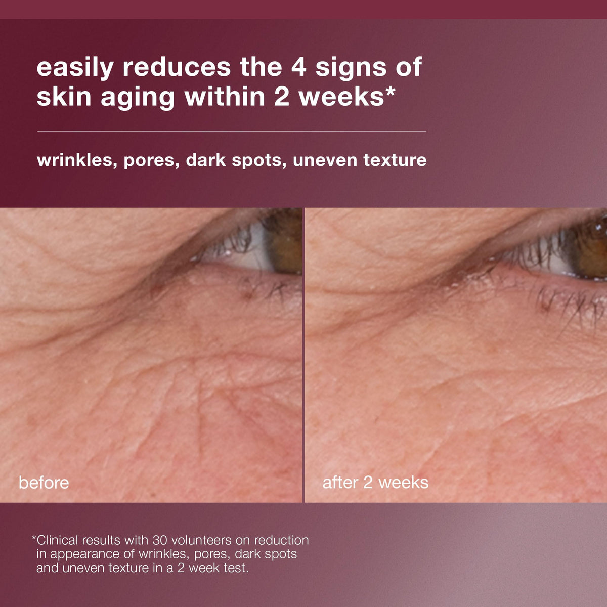 Close-up of the serum texture on skin, Dermalogica illustrating lightweight absorption and hydration