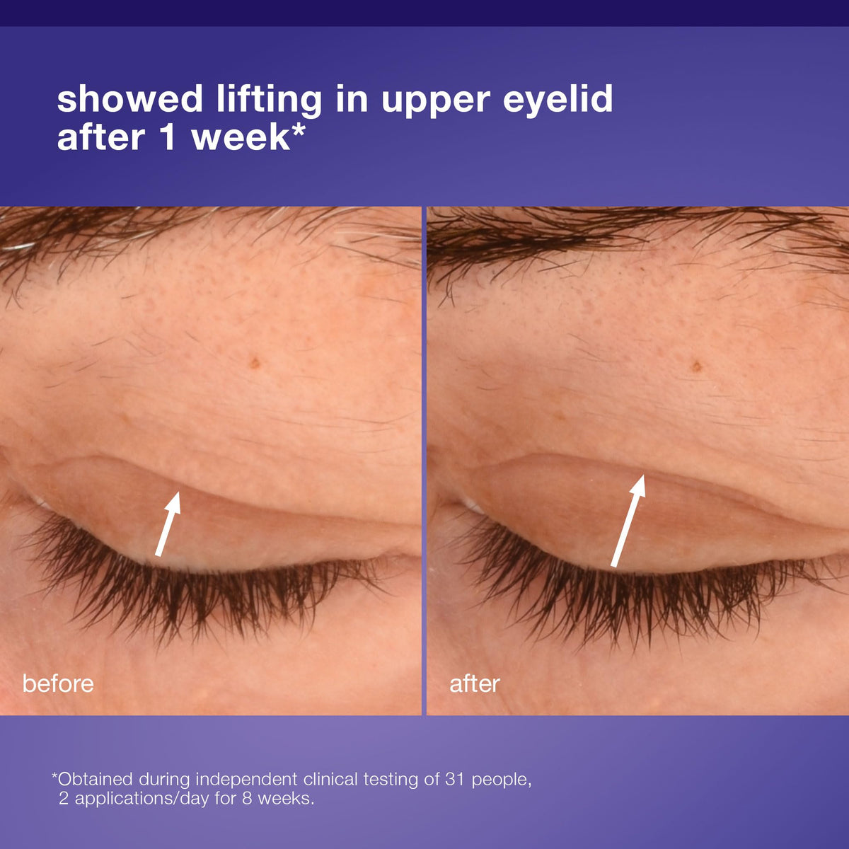Dermalogica quinoa seed extract visual emphasizing texture refinement benefit