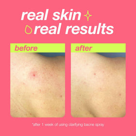 Dermalogica product label close-up highlighting active ingredients