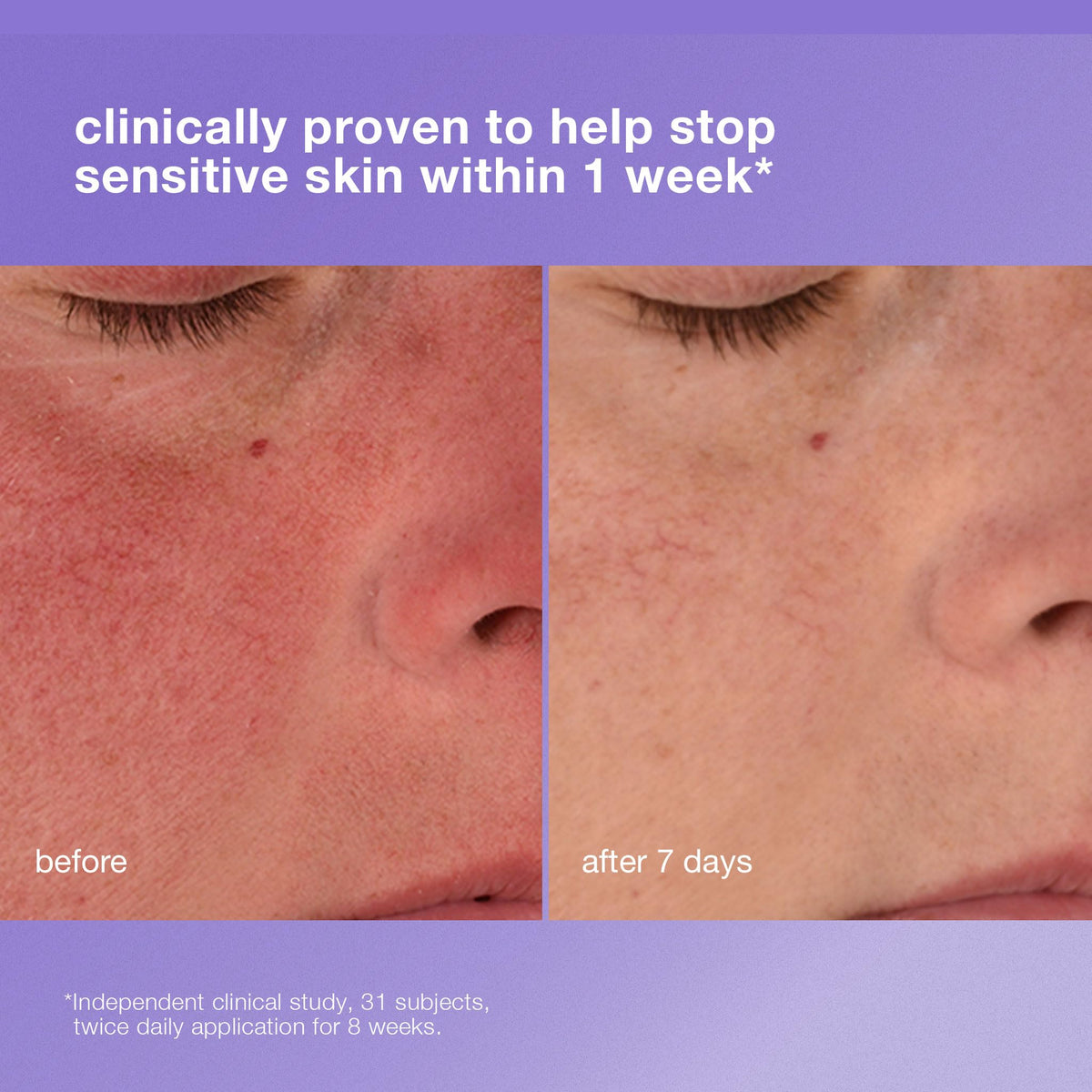 Dermalogica ceramide complex close-up highlighting barrier strengthening