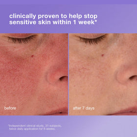 Dermalogica ceramide complex close-up highlighting barrier strengthening