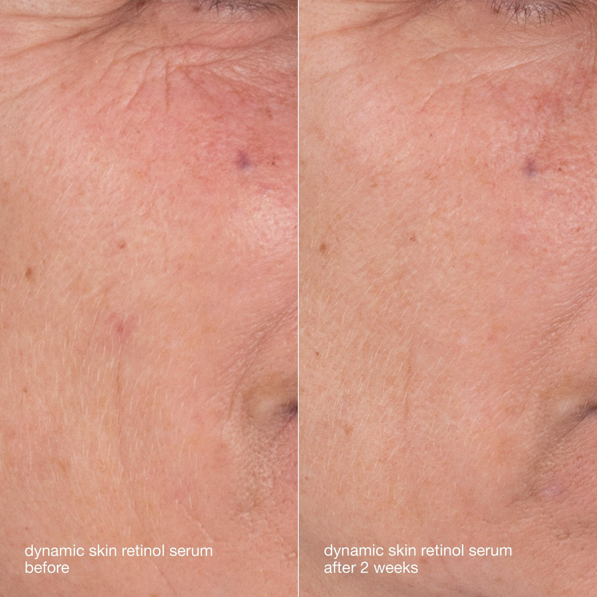 Dermalogica cream texture on hand showing rich hydration and skin-smoothing benefit