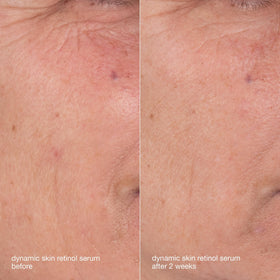 Dermalogica cream texture on hand showing rich hydration and skin-smoothing benefit