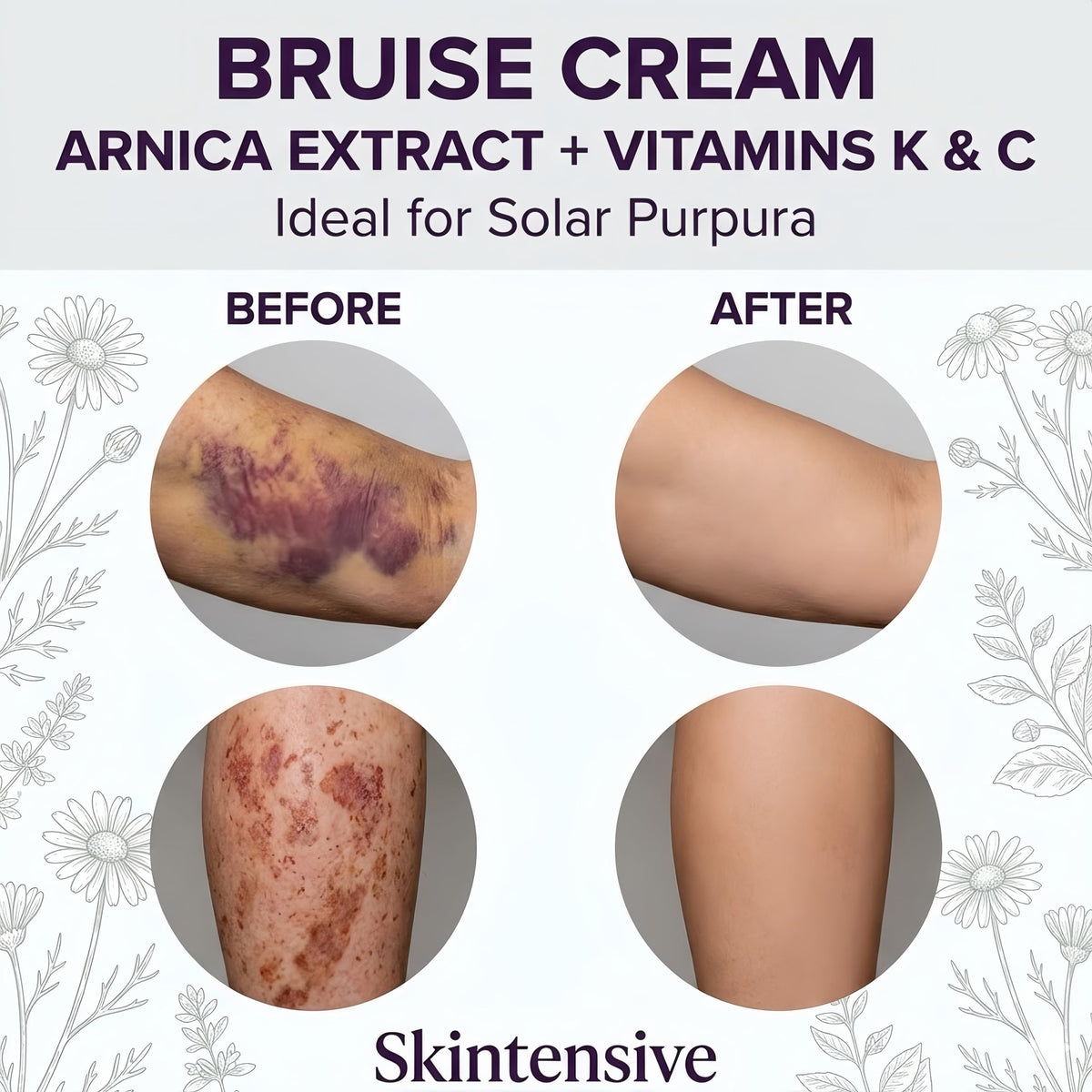 Dermara label ingredients detail highlighting arnica and vitamins K, C, E for renewal