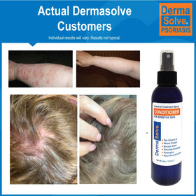 Dermasolve used while combing to detangle and prevent breakage