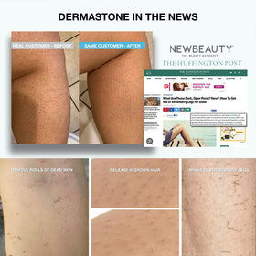 Dermastone packed in toiletry bag highlighting travel-friendly, long-lasting use