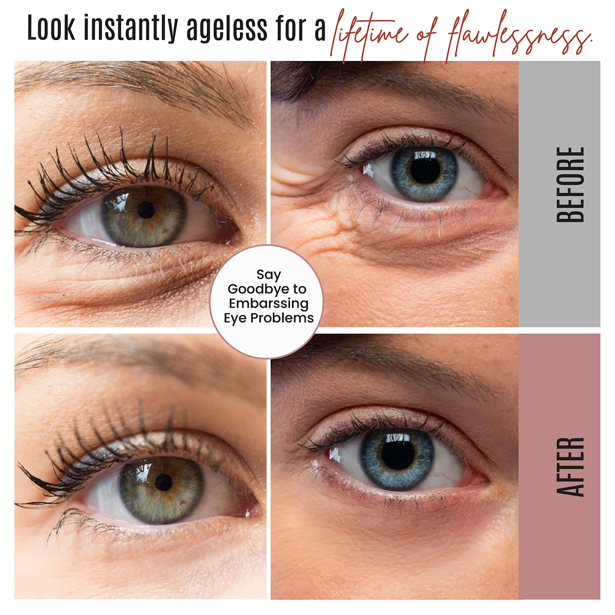 DERMAXGEN before and after image illustrating reduced puffiness benefit