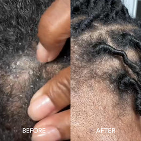 Dermazen on color-treated hair showing maintained vibrancy and softness