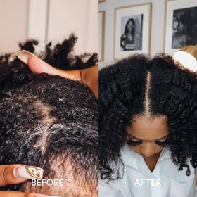 Before and after hair strands treated with Dermazen showing reduced frizz