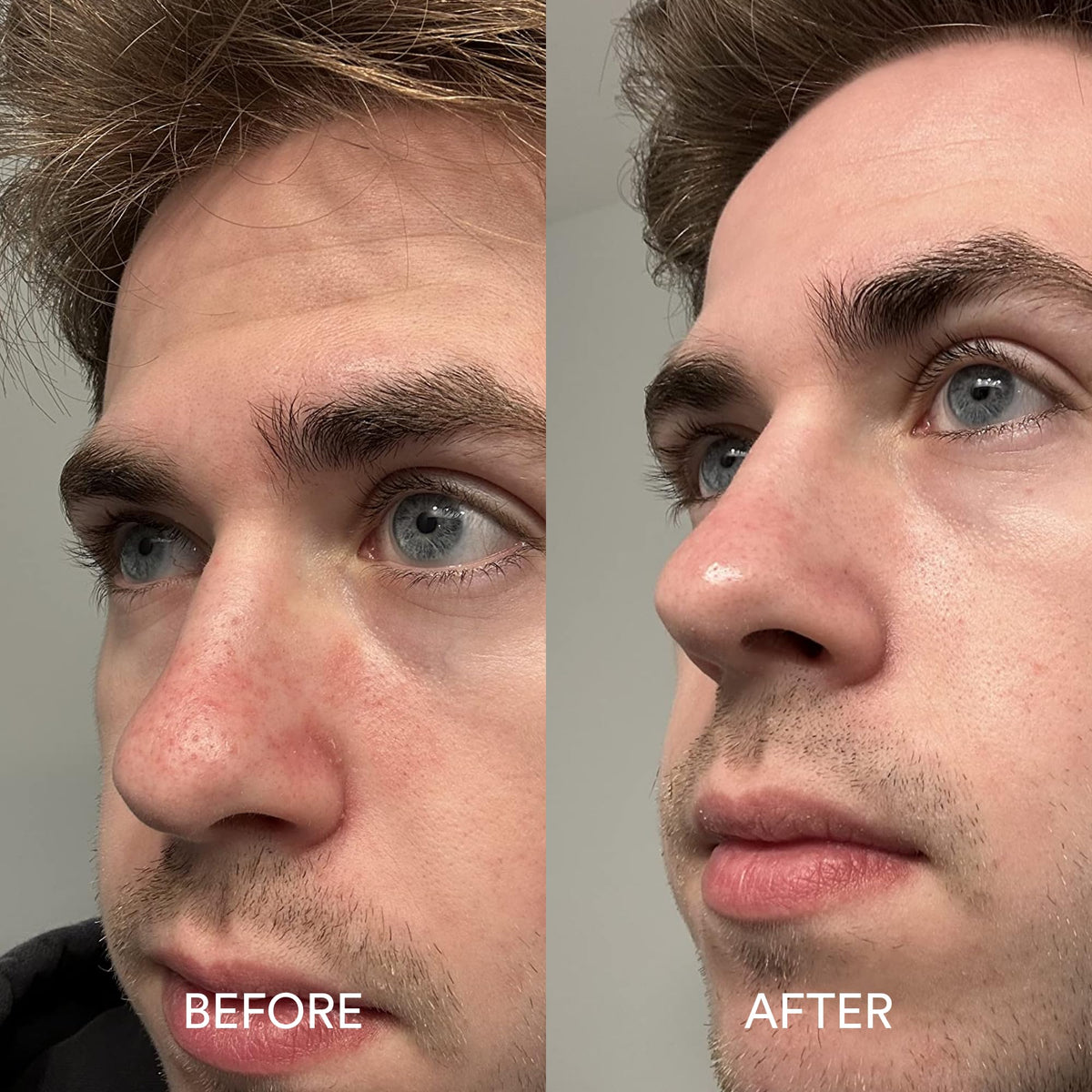 Dermazen serum staged with Dermazen shampoo and conditioner for routine synergy