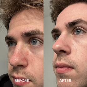 Dermazen serum staged with Dermazen shampoo and conditioner for routine synergy