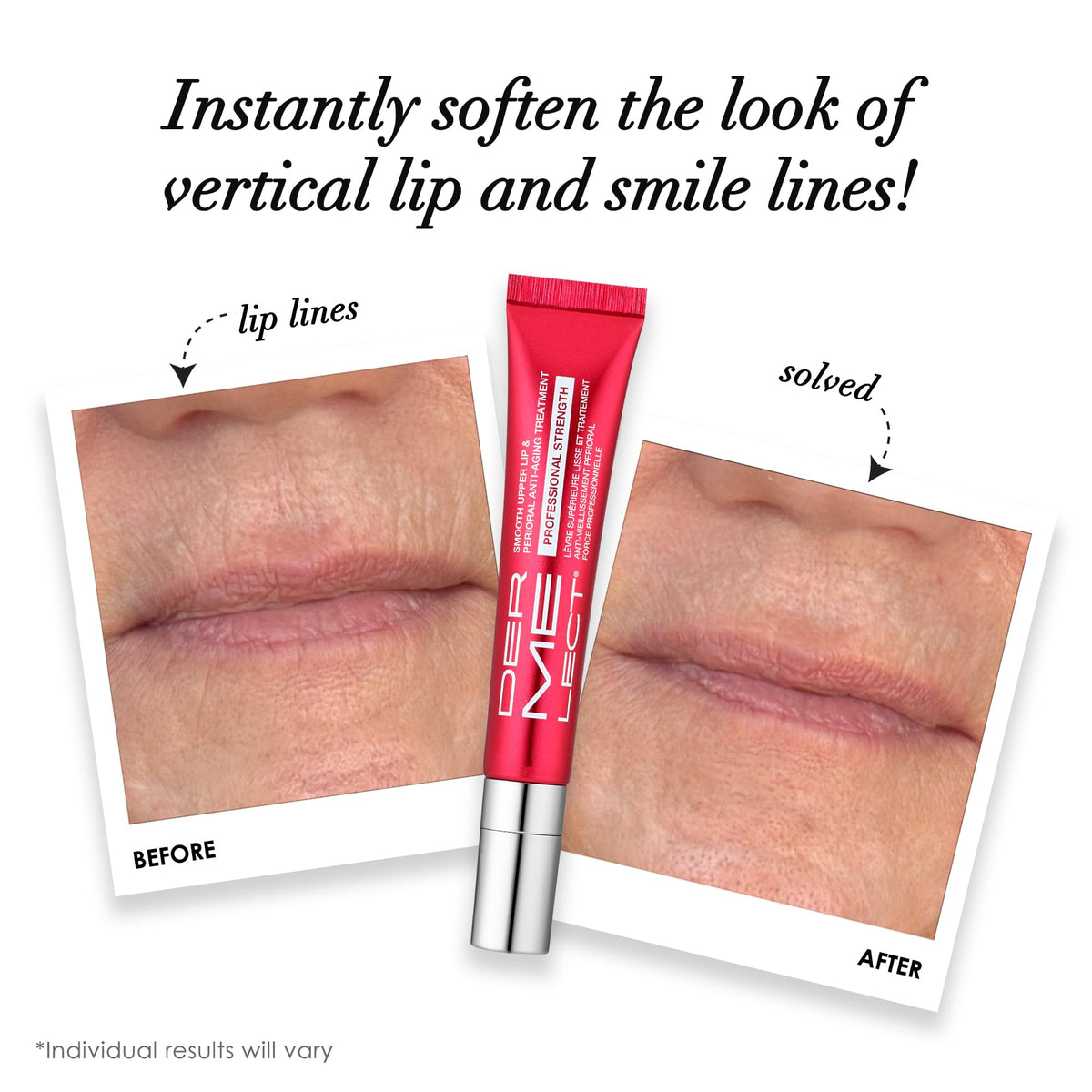 Dermelect ceramic applicator close-up for precise targeted product placement